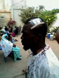 An injured UDP supporter